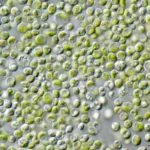 Chlorella vulgaris cells under a microscope