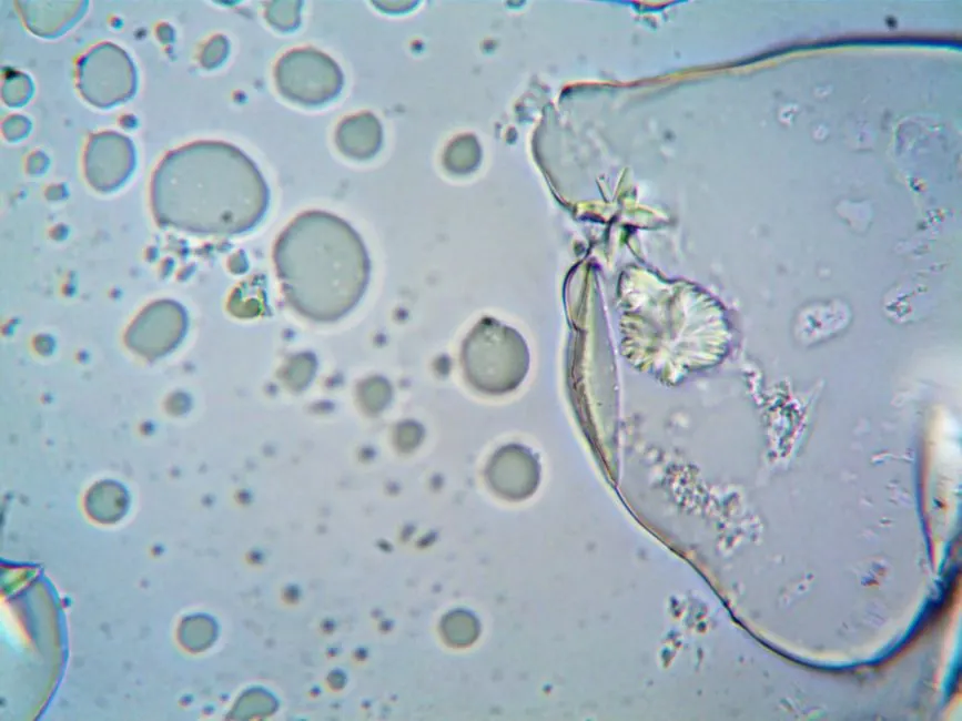 Feeding Rotifers With Chlorella