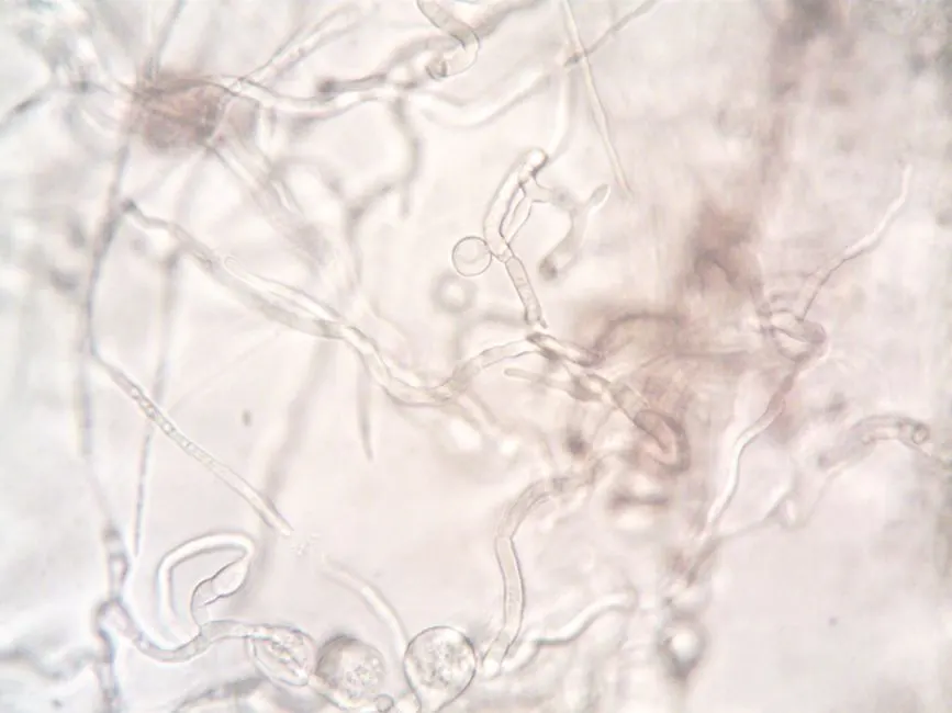 How Spirulina Grows: Filaments and Trichomes