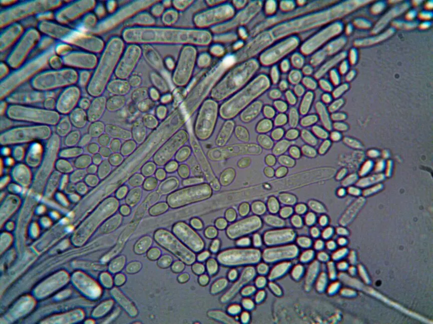 Spirulina vs Chlorella: Two Very Different Microalgae